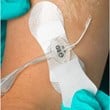 Grip Lok Universal Catheter Securement